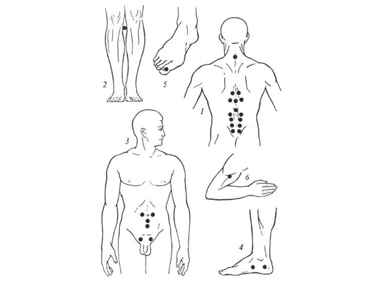 Acupuncture მასაჟი